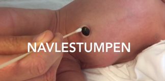 Navlestumpen – slik gjør du